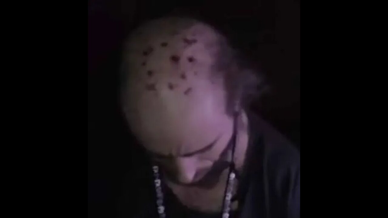 Chance is issuing threats again, CVG and window madness