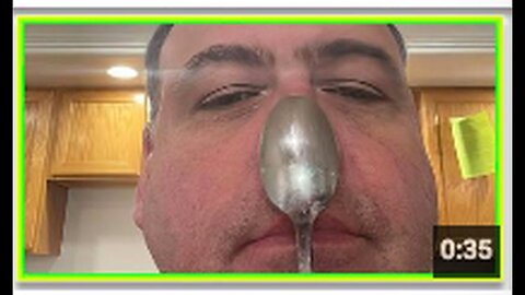 "Man Suffers 3-Hour Nosebleed and Vaccine-Induced DVT Blood Clot"