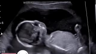 🤣🍼 Mom Laughs While Pregnant! | FunFM