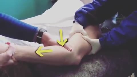 Doctor Fixes Elbow Dislocation