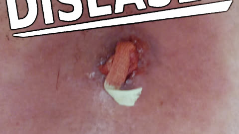 DISEASED