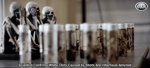 BREAKING: Scientist Confirms White Clots Caused by Shots Are Infectious Amyloid
