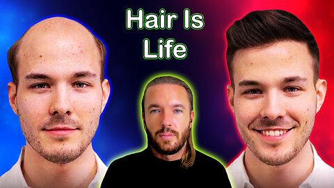 Blackpill: Your Face Will Determine Your Life