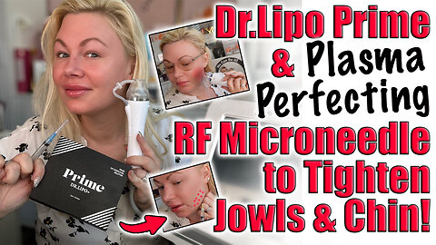 Dr.Lipo Prime & Plasma Perfecting RF Microneedle, Tighten Jowls & Chin! Code Jessica10 Saves
