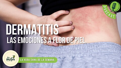 Dermatitis: Las emociones a flor de piel.