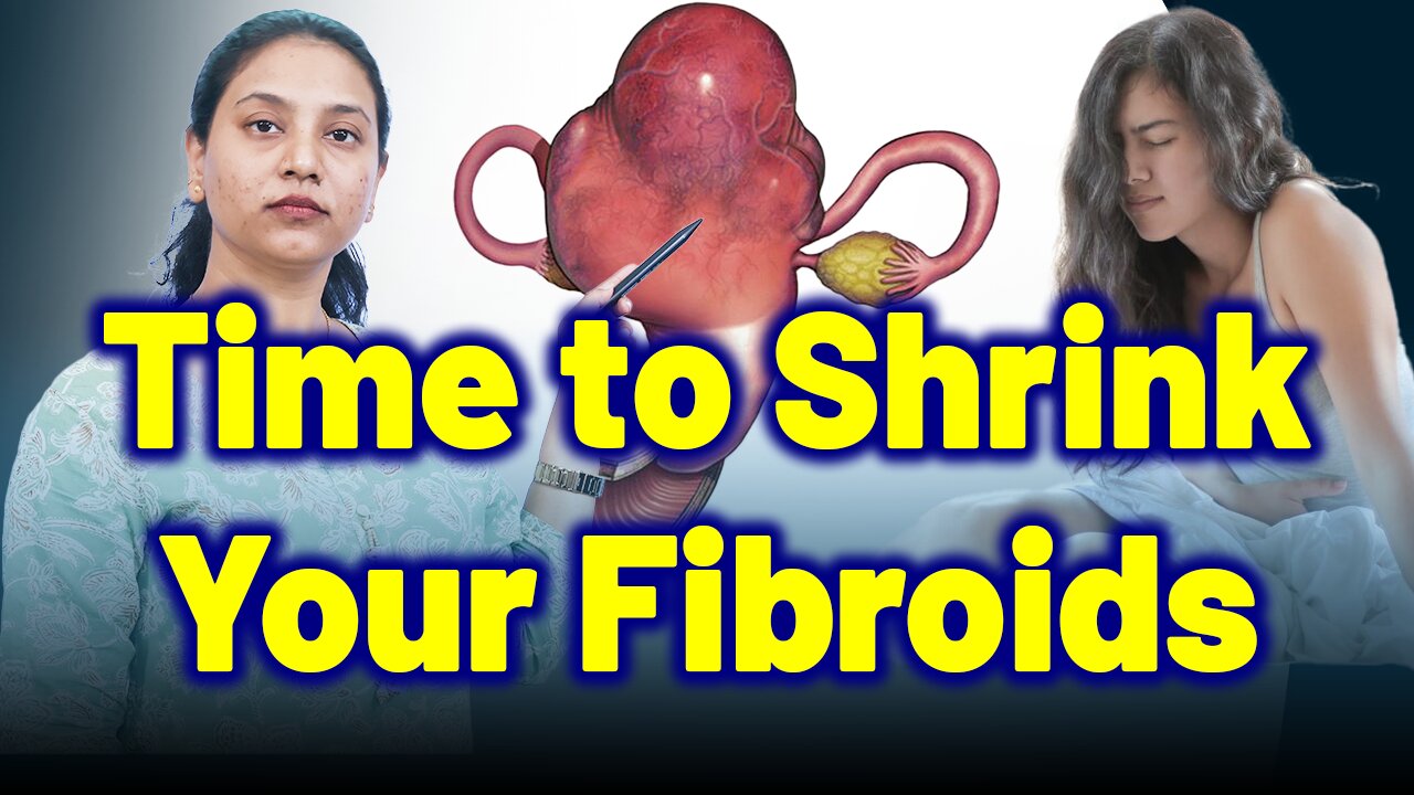It’s Time to Shrink Your Fibroids, Myolysis,Laparoscopic,Cryomyolysis, Ultrasound. |Treatment & Cure