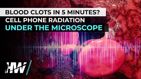 BLOOD CLOTS IN 5 MINUTES? CELL PHONE RADIATION UNDER THE MICROSCOPE