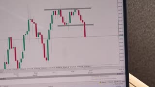 Count the Pips, Not the Dollars 💹 | Professional Trading Mindset