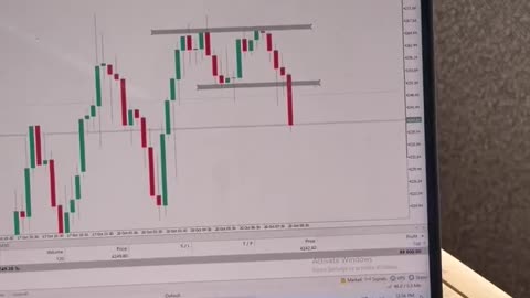 Count the Pips, Not the Dollars 💹 | Professional Trading Mindset