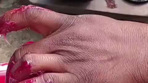 ¿Por Qué La Grasa Viene En Tantos Colores? 🤔