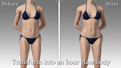 "Transformative Hip Widening Plastic Surgery: A Fresh Approach for the Transgender Community"