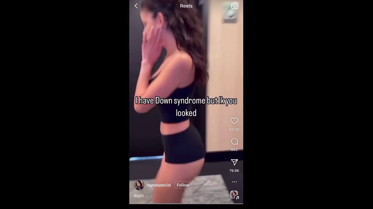 OF girls Faking Down Syndrome to drive traffic to their OF account