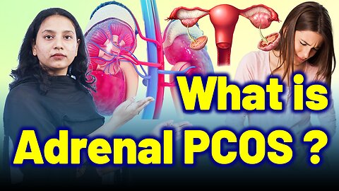 What If Your PCOS Is Actually Adrenal PCOS?" | Treatment Cure Medicine Surgery | Gynaecology