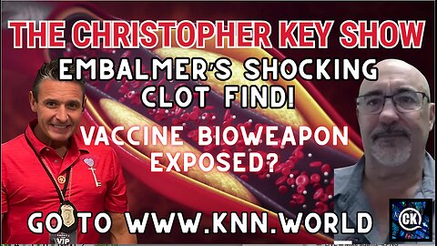 Embalmer’s Shocking Discovery: Richard Hirschman Exposes White Fibrous Clots