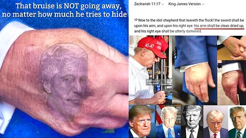 Trump the Idol Shepherd of Zechariah 11:17? - "Right Eye Darkened"-- Mark In The Right Hand