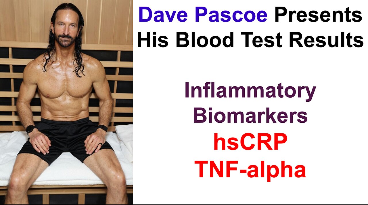 Dave Pascoe Presents His Blood Test Results: PSA, Testosterone, SHBG
