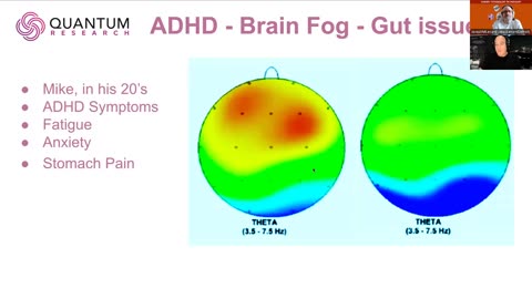 CTP (20260205 S3EFebSpecial2) Stan Kurtz Achieving Proper Brain Function BTS/SP Video