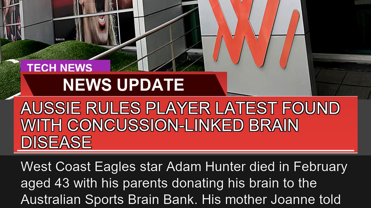 Aussie Rules Player Latest Found with Concussionl
