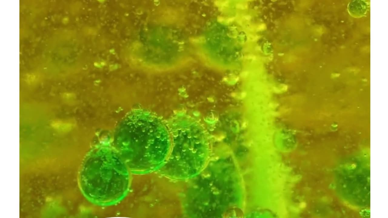 Kidney stones? Relief is just a step away. 💧👨⚕️