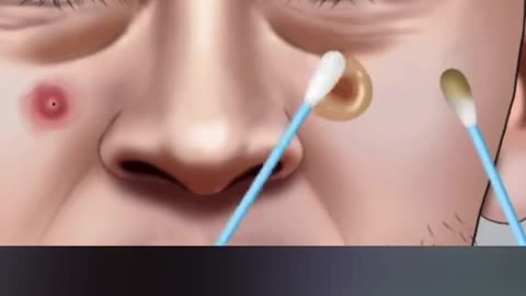 ASMR