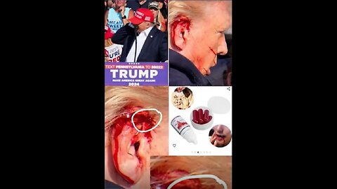 How Trump Survived a FAKE Assassination Attempt.