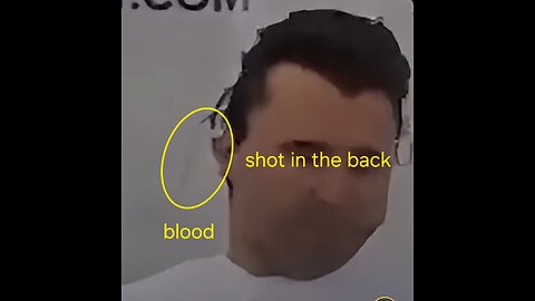 Charlie Kirk shot in the back, exit wound in the front