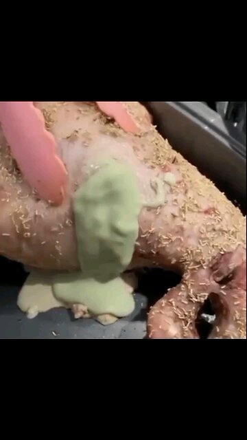 Tumours In Crumbed Meat 🤢😓💔😱