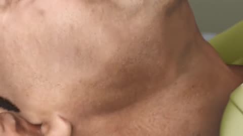 Obstructive Sleep Apnea 3D Animation