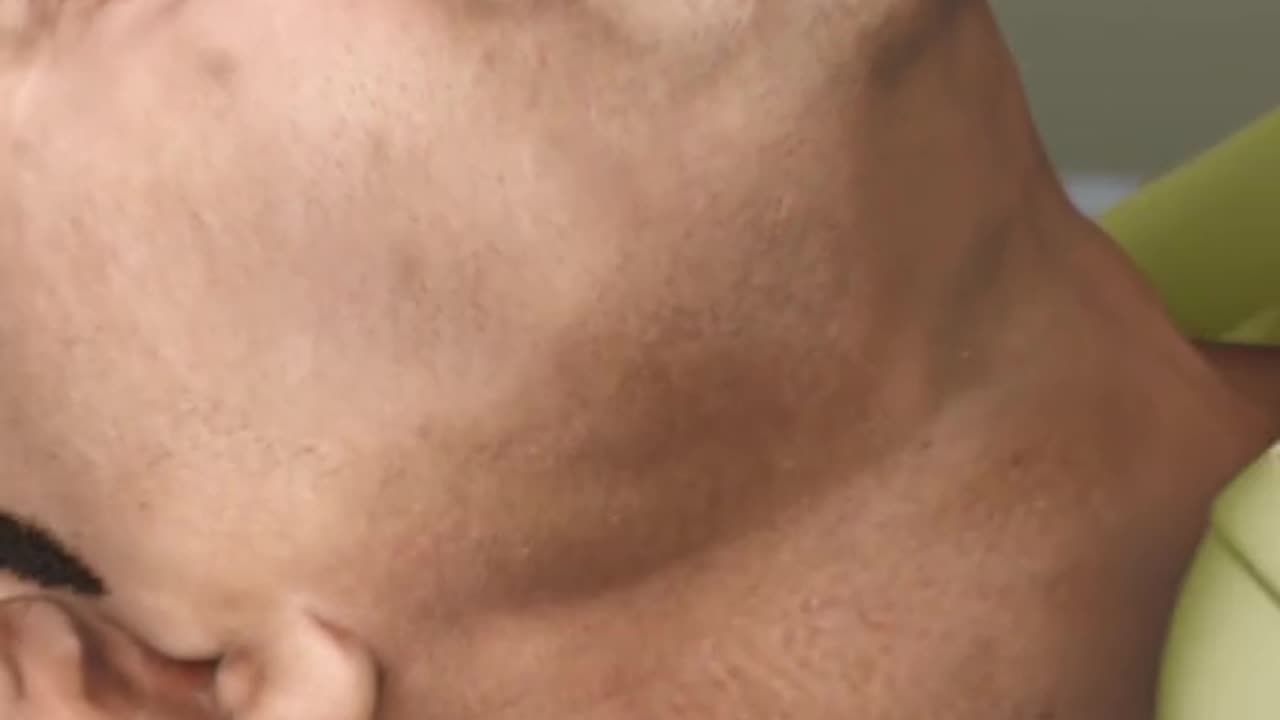 Obstructive Sleep Apnea 3D Animation