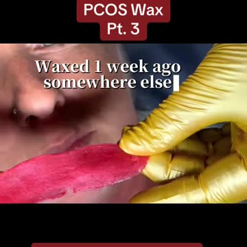 Chin & Upper Lip Waxing in Georgia Using Sexy Smooth Cherry Desire Wax | @meganlmt.le.elevat