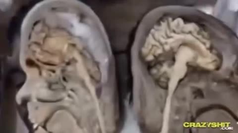 Niggers have their frontal lobes either underdeveloped or not developed