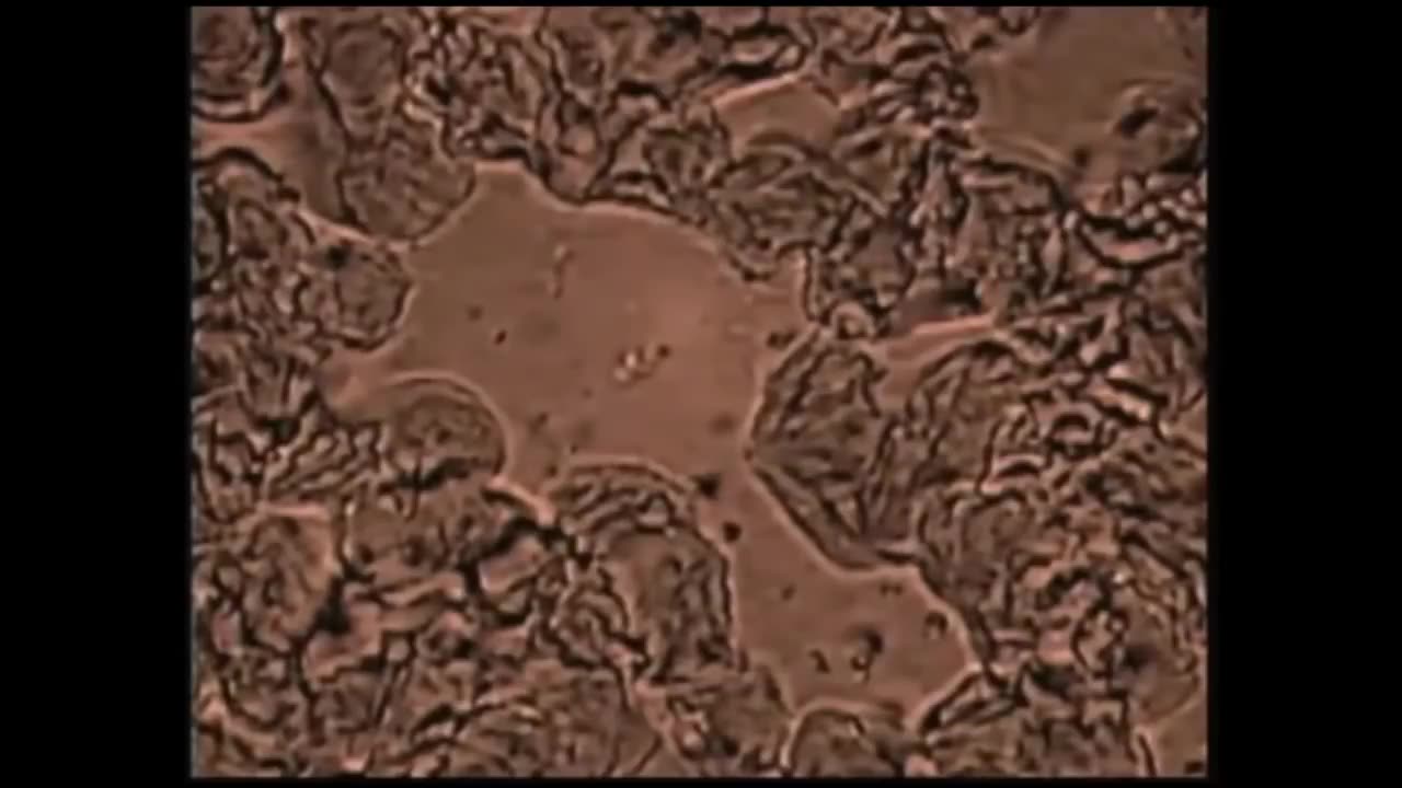 Cancer The Forbidden Cures