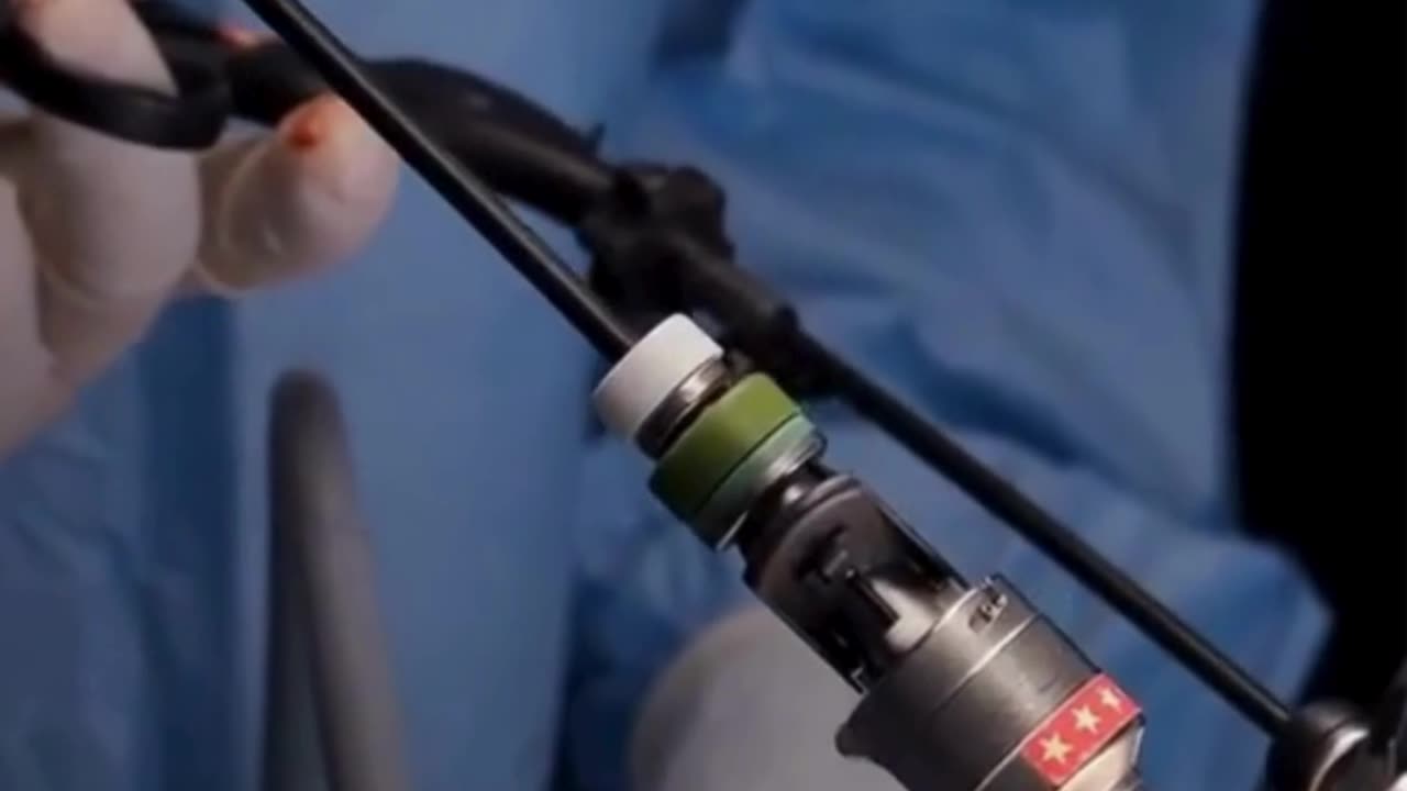 Laparoscopic Urology Surgery in Madurai Minimally Invasive Urology Care