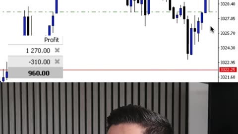 Live trading XAUUSD #forex #daytrading