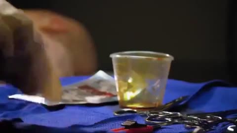 American Circumcision