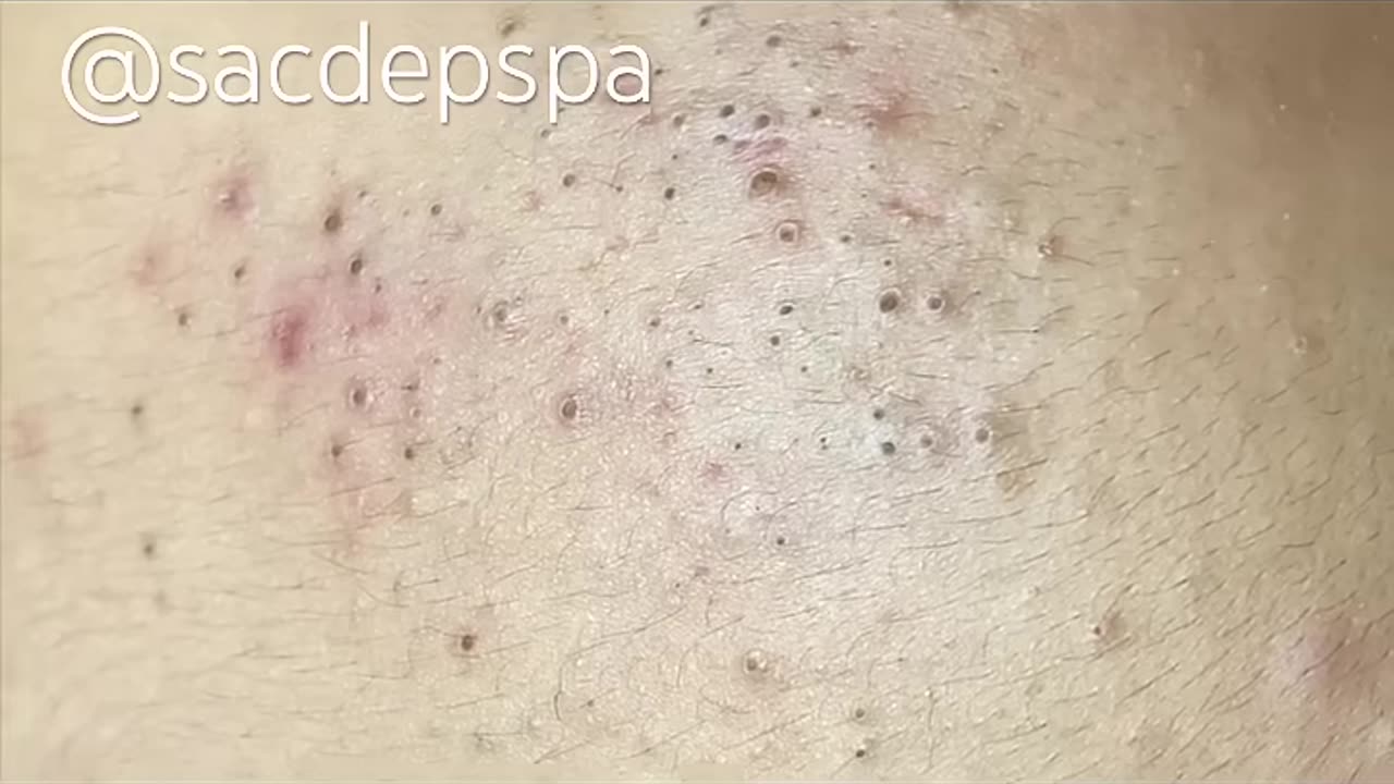 Sac dep spa #0407