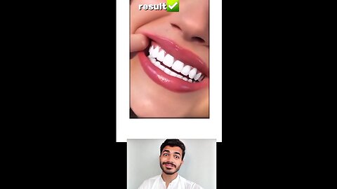 Bad breath and yellow teeth Solution 😇