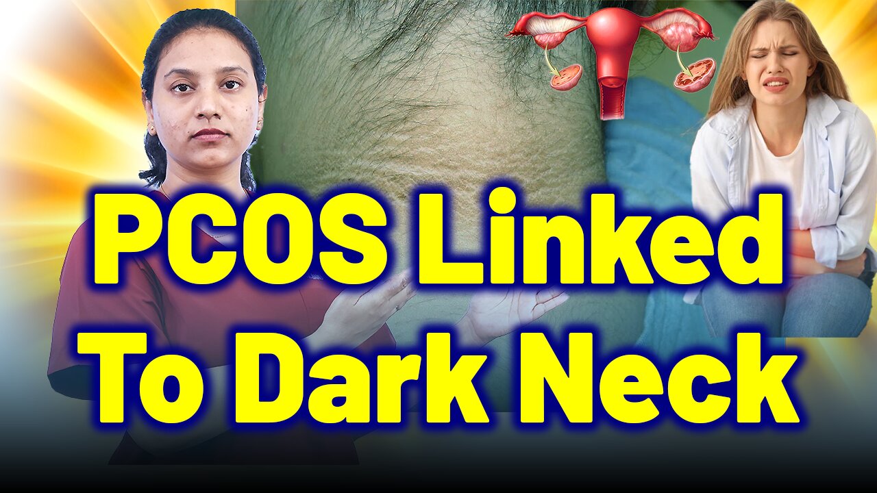 PCOS Leads to Dark Neck, Dark Underarms, Skin Darkening, Acanthosis Nigricans. | Treatment Cure |