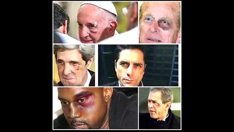 SATANIC ELITES EXPOSED - PT 5 - SYMBOLISM WILL BE THEIR DOWNFALL - THE BLACK EYE/RED SHOE CLUB ☠️