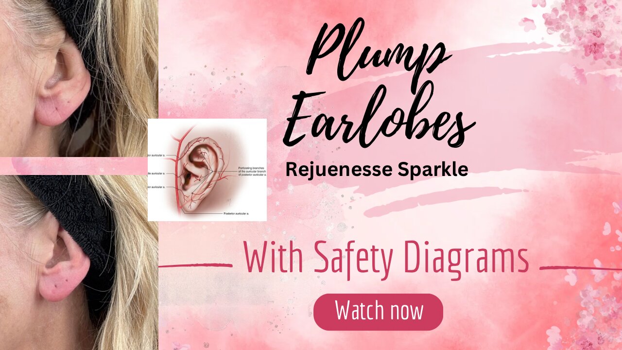 Plump My Earlobes - Rejeunesse Sparkle