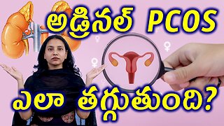 అడ్రినల్ PCOS ఎలా తగ్గుతుంది? Best and Trusted Homeopathy Treatment For Adrenaline PCOS Cure