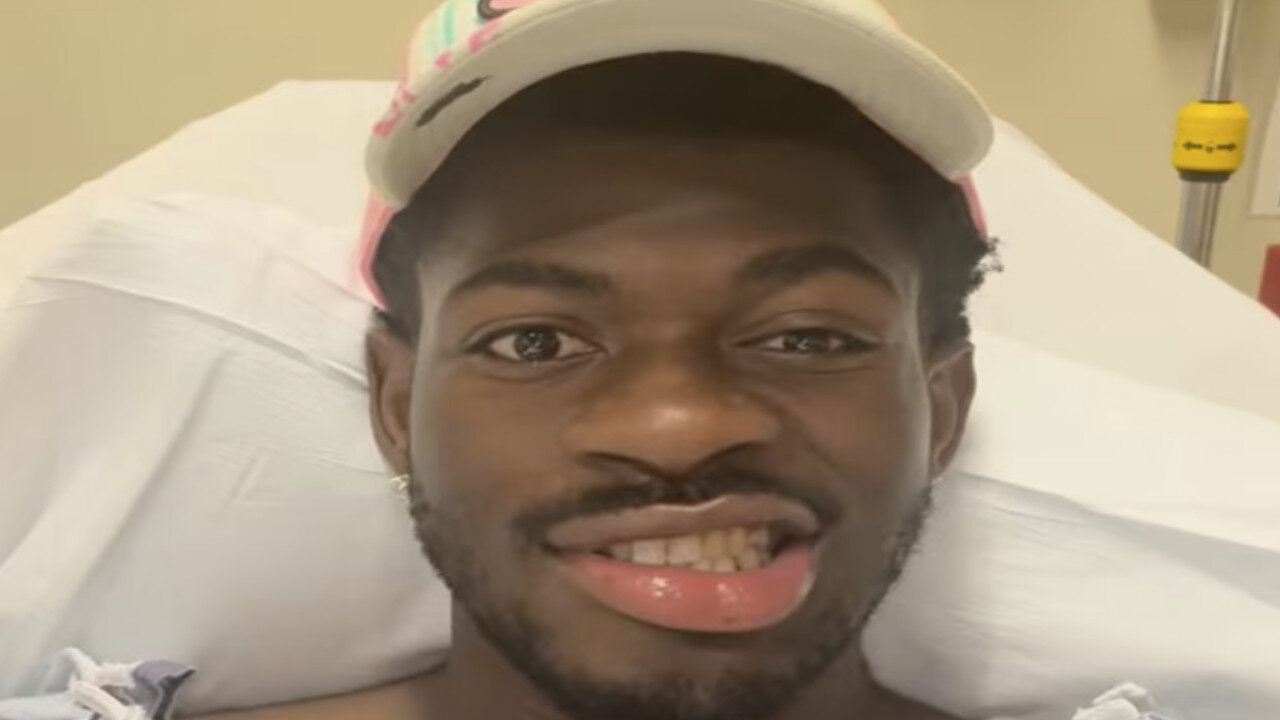 Lil Nas X has Revealed That He Have Bell's Palsy: The Judgment of the Lord is real Repent Israel!!!
