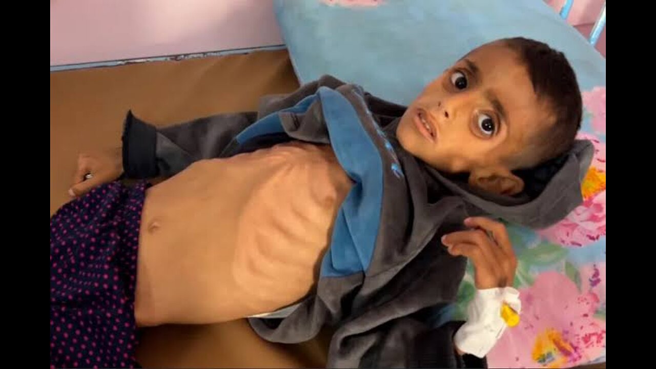 “I don’t think it’s that” — Trump on if he thinks a genocide is happening in Gaza