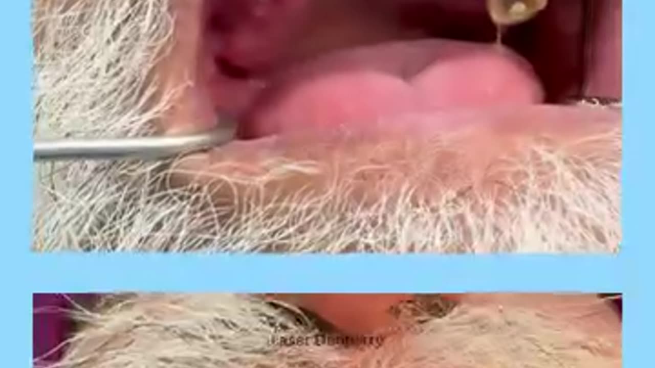 🦷 Get the Best Dental Implants in Mohali at Trusted Prices