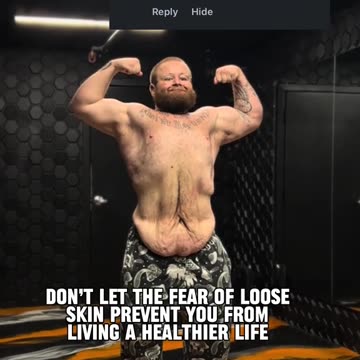 An amazing weight loss