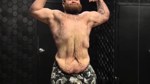 An amazing weight loss