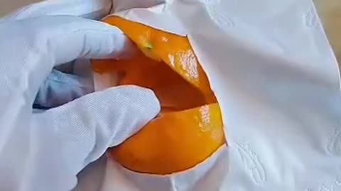Surgery