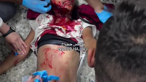 Martyrs, including children, and injuries as a result of targeting a tent