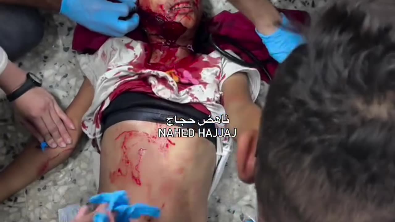 Martyrs, including children, and injuries as a result of targeting a tent