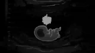 This_footage_claiming_that_children_are_being_sacrificeD ABORTION